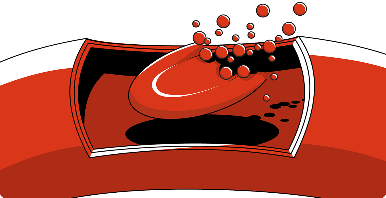 Continuer à afficher le globule rouge HPN